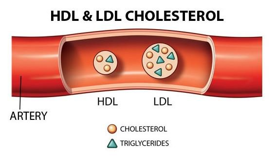 Chỉ số mỡ máu cao phụ thuộc vào hàm lượng cholesterol LDL, HDL và triglyceride.
